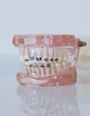 Dental Treatment