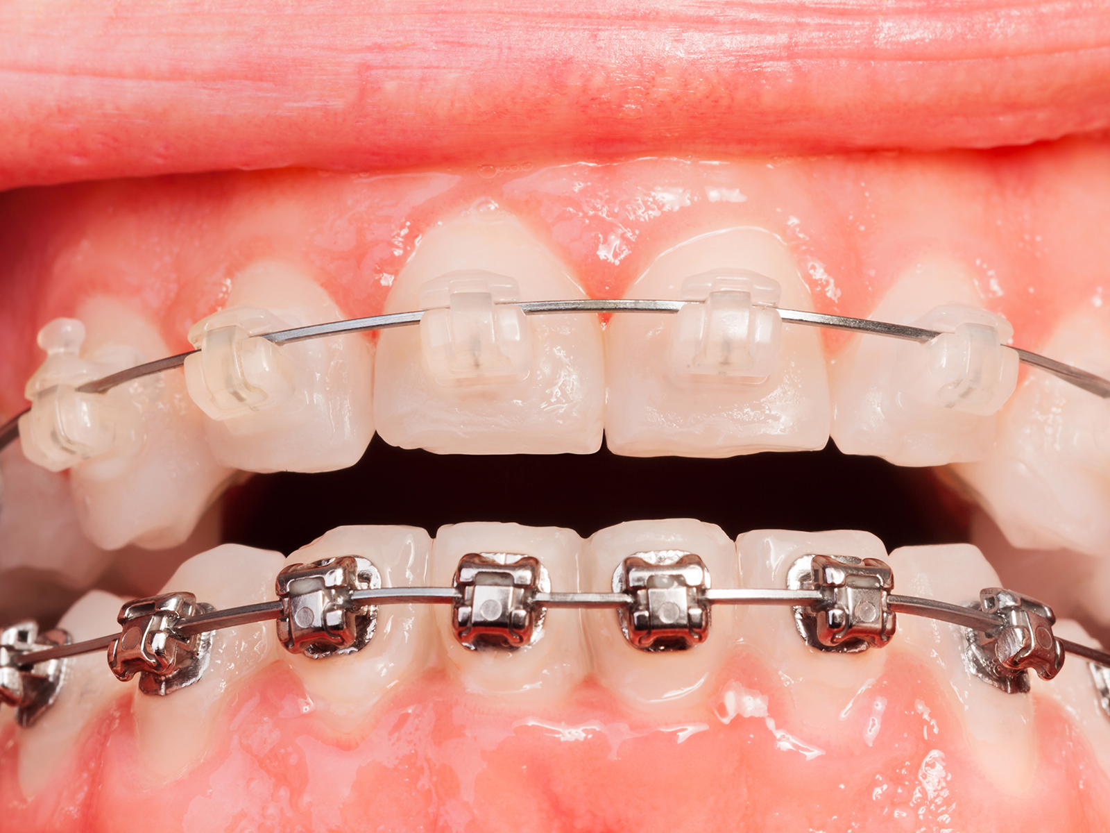 Orthodontics