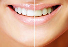 Our Dental Specialites