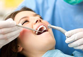 Dental Aligners